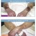 DermaSaver® AT1300-S HPST1300